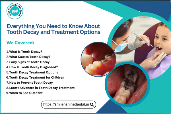 Everything You Need to Know About Tooth Decay and Treatment Options