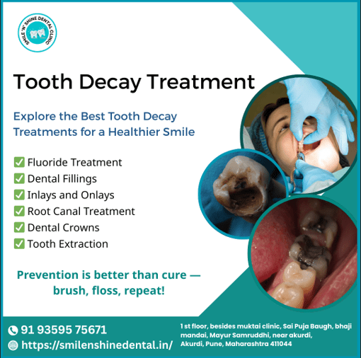 blog-7-img https://smilenshinedental.in/wp-content/uploads/2025/07/blog-7-img.png