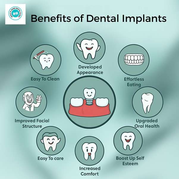 Smile 9-2 Benefit of Dental Implant Procedure