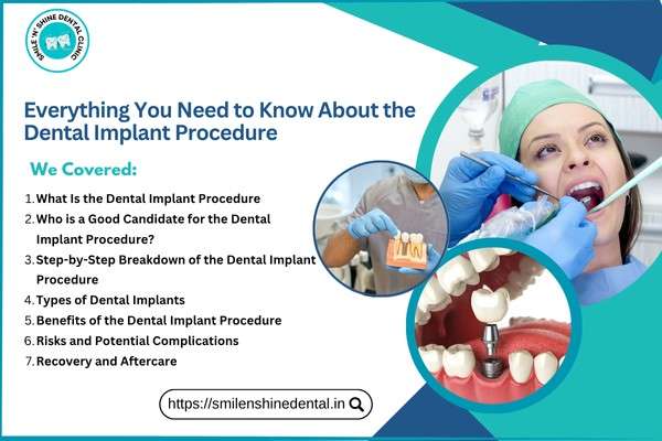 Everything You Need to Know About the Dental Implant Procedure